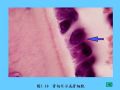 组织胚胎学-5.软骨和骨图41