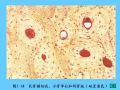 组织胚胎学-5.软骨和骨图50