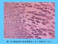组织胚胎学-5.软骨和骨图54