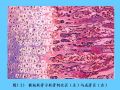组织胚胎学-5.软骨和骨图55