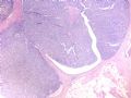 Breast papillary lesion cqz (1)图1