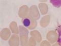 血液形态学基础--正常骨髓细胞--红系图10