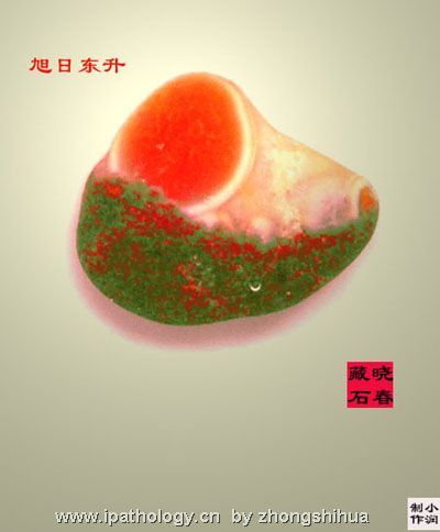 华夏多锦绣，奇石孕精华（转）图4