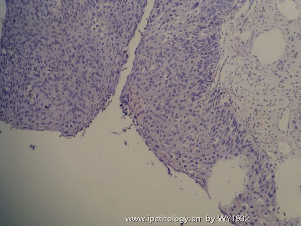 宫颈涂片图9