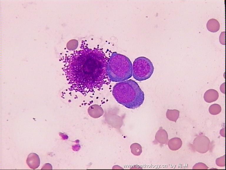红细胞系各期细胞的特点--附图片图1