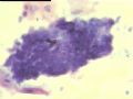 看看我们科室的痰液基细胞学图9