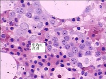 骨髓活检红系细胞特点图2
