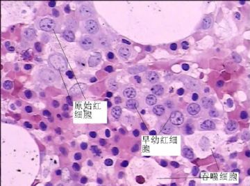 骨髓活检红系细胞特点图6