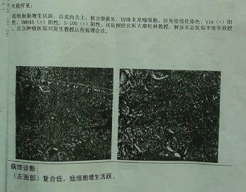 上传会诊皮肤病理79图3