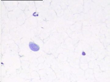 1187宫颈传统涂片，43岁图4