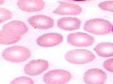 组胚课件4--血液和血细胞的发生【091116】图5