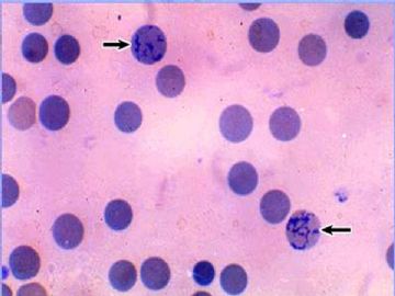 组胚课件4--血液和血细胞的发生【091116】图6