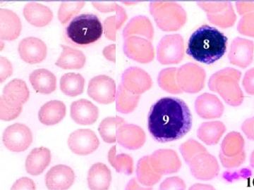 组胚课件4--血液和血细胞的发生【091116】图21