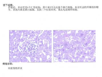 请版主和老师们帮忙看看肝活检图7