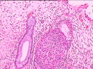 宫颈组织图4