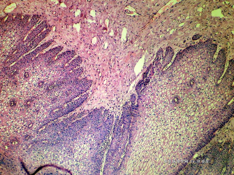 宫颈组织图3