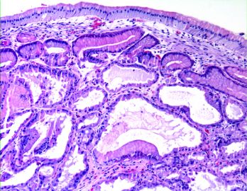 diagnosis ?图2