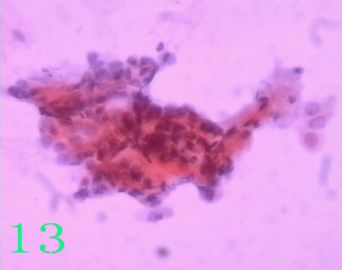宫颈液基 求助图13
