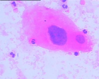 宫颈液基细胞学28/08图3