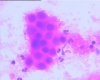 宫颈液基细胞学28/08图8