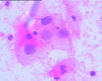 宫颈液基细胞学28/08图9