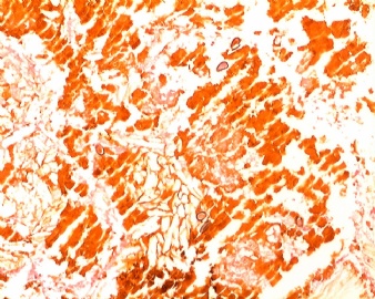 胆囊壁、胆结石（大体：图1）；胆结石图4