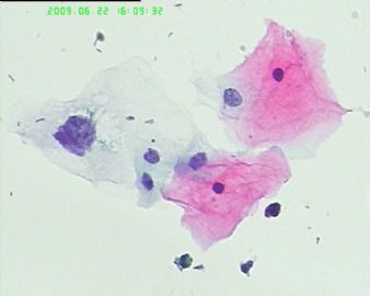 宫颈液基4183图1