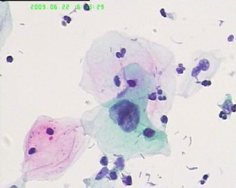 宫颈液基4183图5