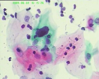 宫颈液基4183图8
