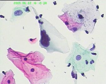 宫颈液基4183图10