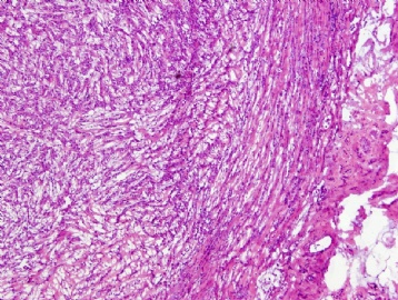 35 Year old with testicular nodule图1