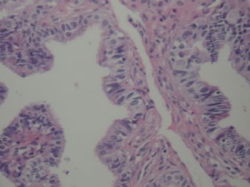 输卵管囊泡图7