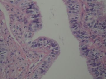 输卵管囊泡图8