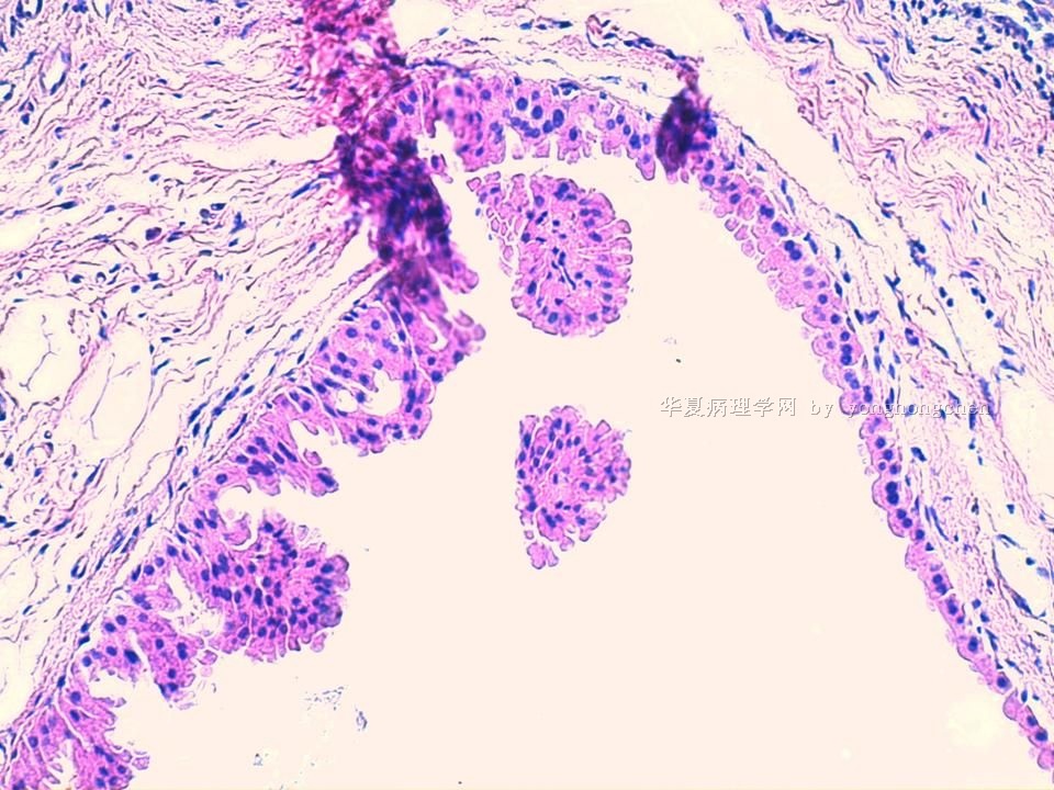 大汗腺化生？图2