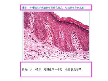 基础病理图片讨论-3（答案公布）图1