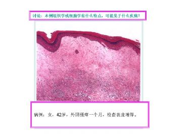 基础病理图片讨论-3（答案公布）图2