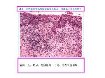 基础病理图片讨论-3（答案公布）图4