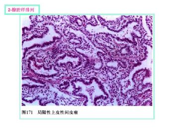 软组织肿瘤的十三种排列方式图3