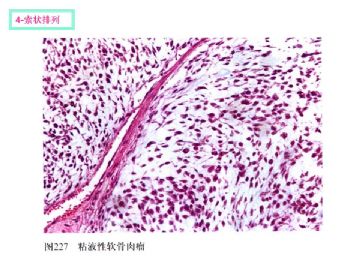 软组织肿瘤的十三种排列方式图9