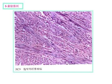 软组织肿瘤的十三种排列方式图13