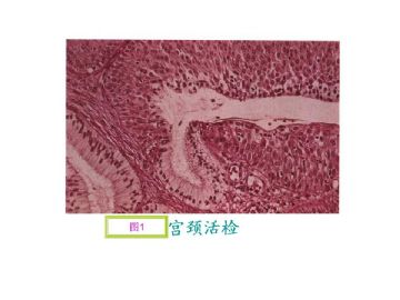 基础病理图片讨论-4（答案公布）图1