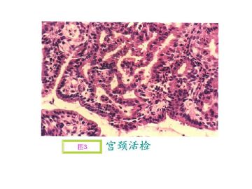 基础病理图片讨论-4（答案公布）图3