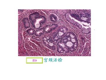 基础病理图片讨论-4（答案公布）图9