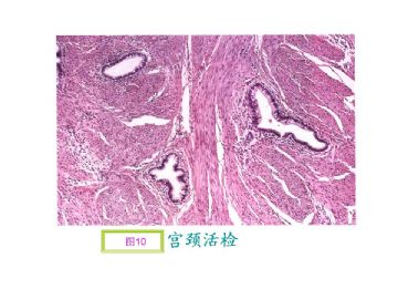 基础病理图片讨论-4（答案公布）图10