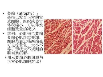 病理学名词图解-1图1