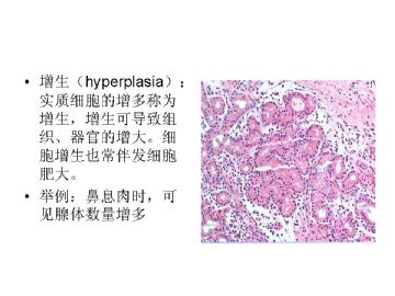 病理学名词图解-1图3