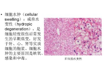 病理学名词图解-1图6