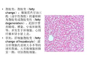 病理学名词图解-1图7