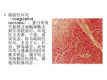 病理学名词图解-1图10