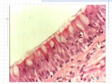 组织胚胎学-上皮组织图片图14